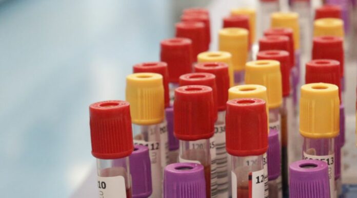 Botulino, dal 2001 al 2024 segnalati 1.276 casi in Italia