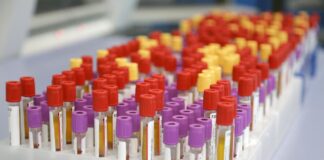 Botulino, Meo (Artemisia Lab) “Attenzione alle conserve fatte in casa”