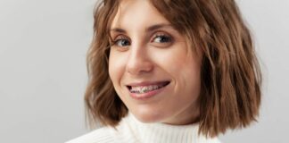 Italiani e sorriso, sempre più adulti con l’apparecchio ortodontico