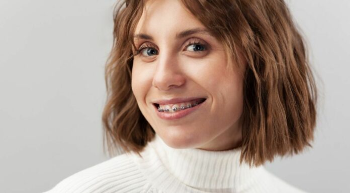 Italiani e sorriso, sempre più adulti con l’apparecchio ortodontico