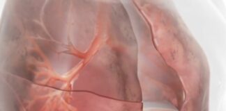 Innovazioni terapeutiche nella BPCO con enfisema