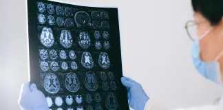 Tumori, tecniche di imaging sempre più innovative per contrastare la malattia