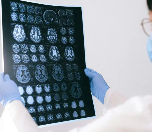 Tumori, tecniche di imaging sempre più innovative per contrastare la malattia