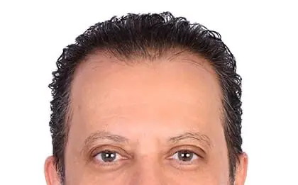 الصرحي: هناك إعادة اصطفاف إقليمي بعد تقدم المجلس الانتقالي الجنوبي اليمني في الجنوب