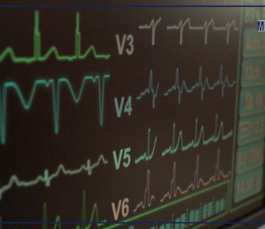 In Italia 100 mila casi di ictus ogni anno, prevenzione e cure fanno la differenza