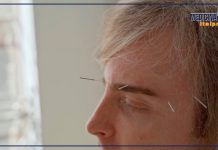 Agopuntura pratica terapeutica millenaria, ecco perché parlarne è utile