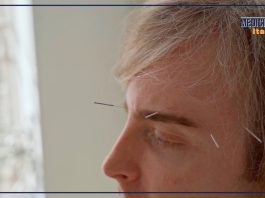 Agopuntura pratica terapeutica millenaria, ecco perché parlarne è utile