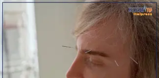 Agopuntura pratica terapeutica millenaria, ecco perché parlarne è utile