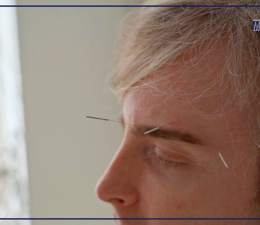 Agopuntura pratica terapeutica millenaria, ecco perché parlarne è utile