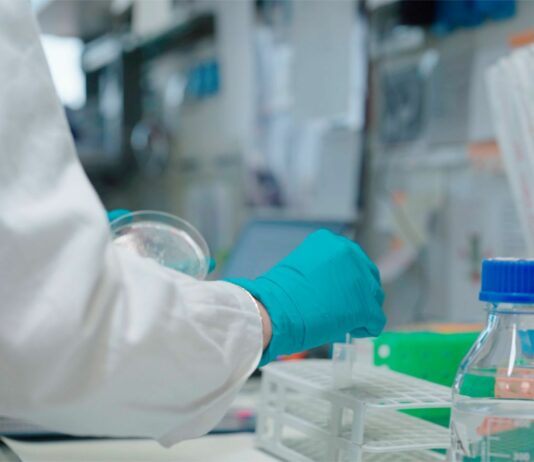 Ematologia, al San Raffaele di Milano integrazione tra ricerca e cura