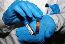 Hantavirus, negativi i test analizzati a Milano e allo Spallanzani