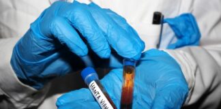 Hantavirus, negativi i test analizzati a Milano e allo Spallanzani