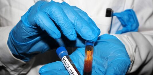 Hantavirus, negativi i test analizzati a Milano e allo Spallanzani
