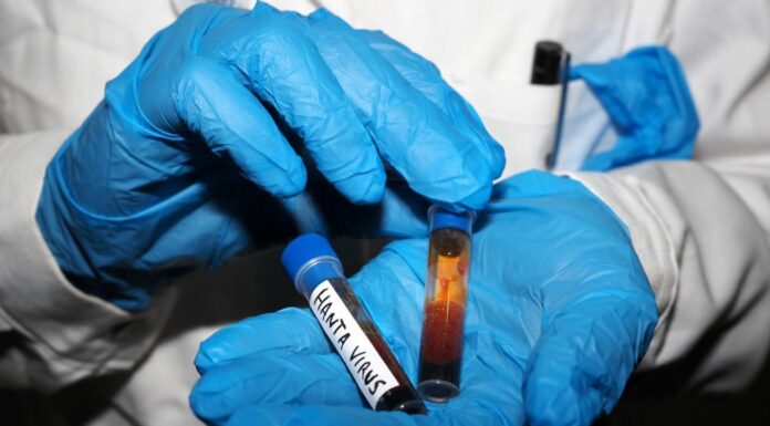 Hantavirus, negativi i test analizzati a Milano e allo Spallanzani