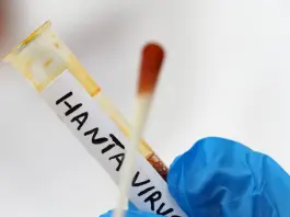 Hantavirus, parla la sindaca di Villa San Giovanni: “Il 25enne in quarantena sta bene, non ha sintomi”