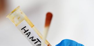 Hantavirus, negativa la paziente argentina ricoverata al Policlinico di Messina