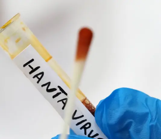 Hantavirus, negativa la paziente argentina ricoverata al Policlinico di Messina