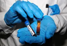 Hantavirus, lo Spallanzani: “Da noi solo campioni biologici del paziente sintomatico”