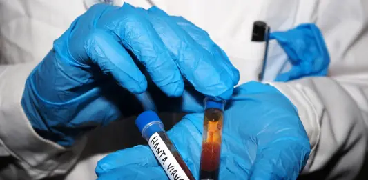 Hantavirus, lo Spallanzani: “Da noi solo campioni biologici del paziente sintomatico”