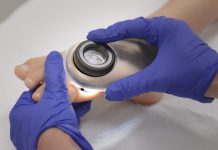 I dieci falsi miti sul melanoma pediatrico, i consigli dell’Ospedale Bambino Gesù