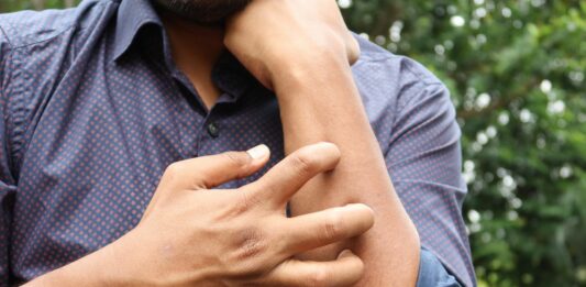 Studio Novartis, l’orticaria cronica spontanea costa 4.200 euro l’anno a paziente