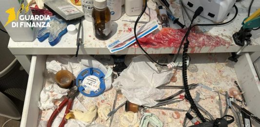 Sequestrato a Latina uno studio odontoiatrico abusivo, denunciato un falso dentista