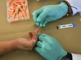 110mila persone con Hiv seguite dai centri pubblici in Italia, 73% uomini