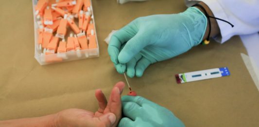 110mila persone con Hiv seguite dai centri pubblici in Italia, 73% uomini