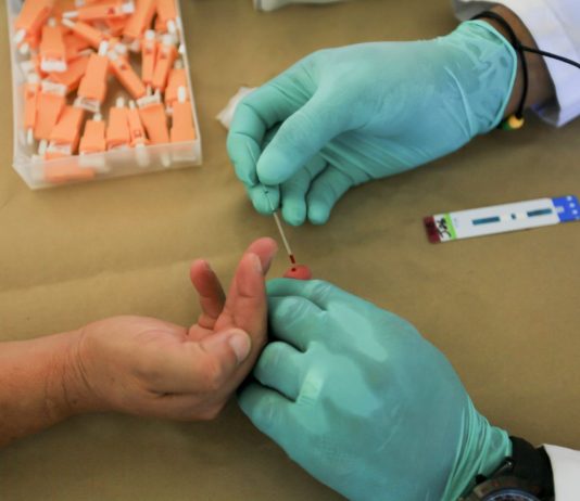 110mila persone con Hiv seguite dai centri pubblici in Italia, 73% uomini