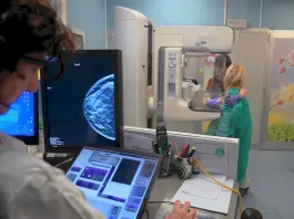 Screening mammografico, Regione Lazio ed Europa Donna Italia insieme per la prevenzione