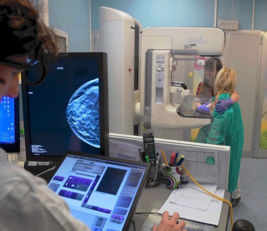 Screening mammografico, Regione Lazio ed Europa Donna Italia insieme per la prevenzione
